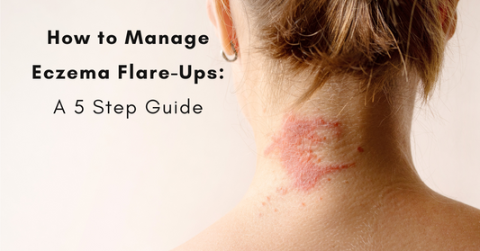 5 Step Guide to Managing Eczema | Strawberry