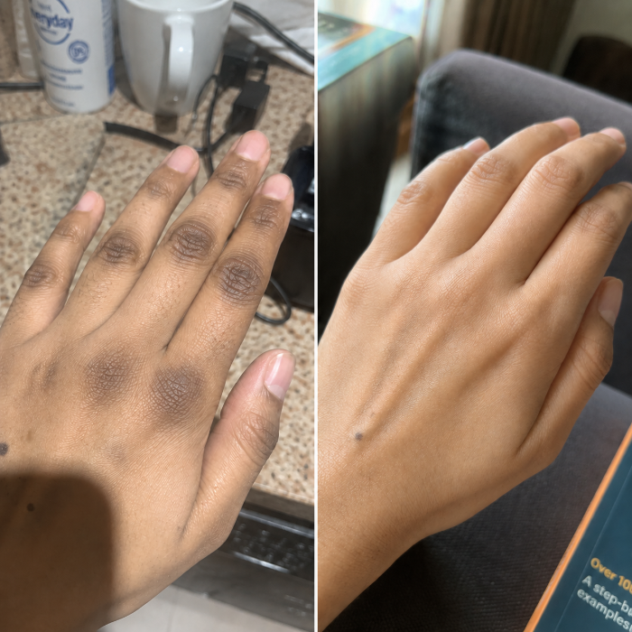 Michelle's hands before and after