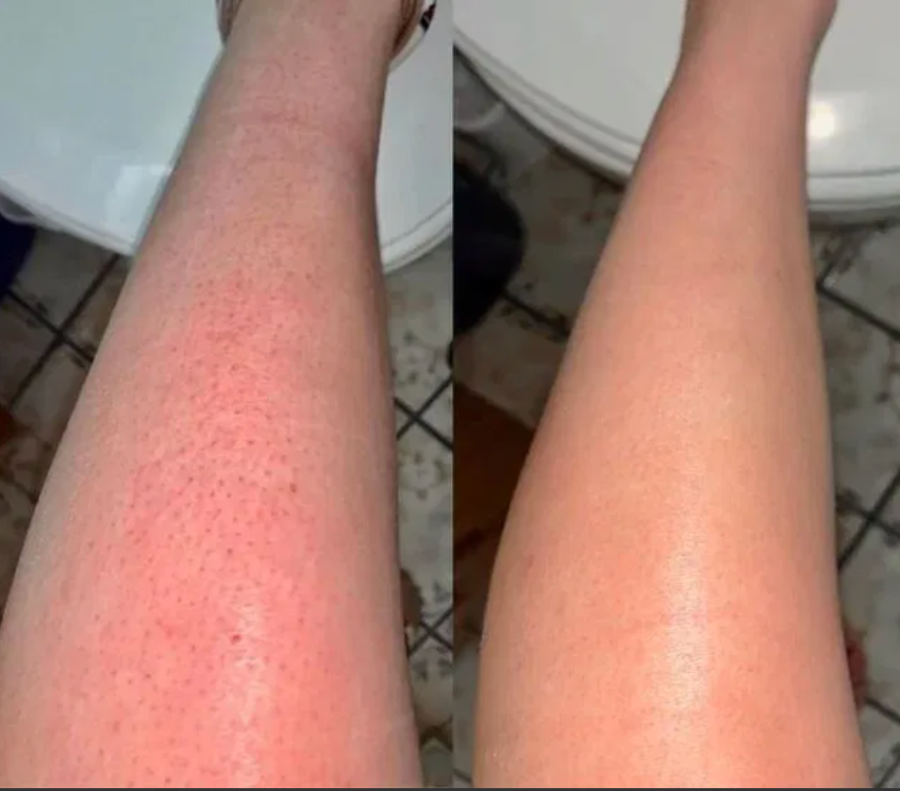 Amari's legs before and after
