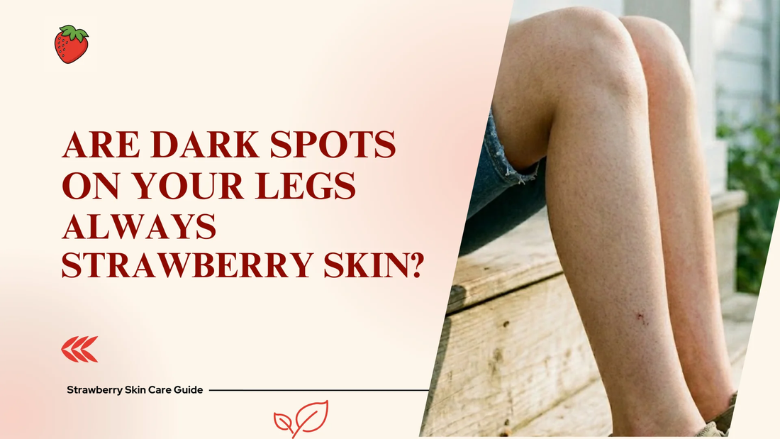 Are Dark Spots on Legs Always Strawberry Skin?
