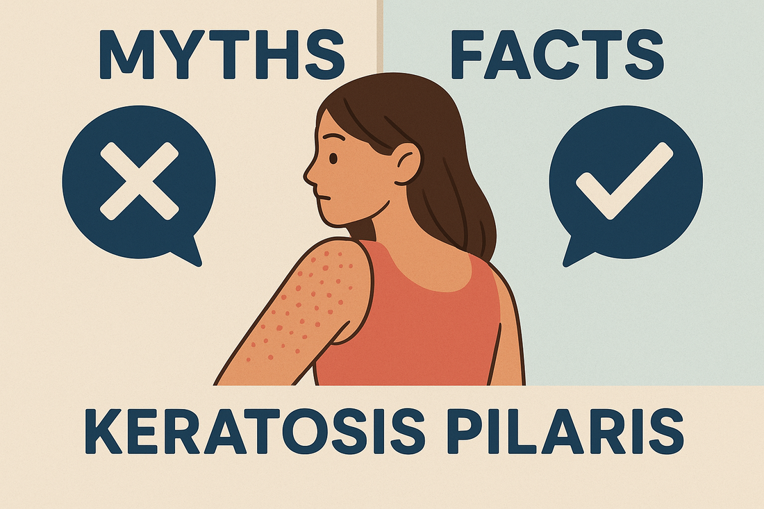 Keratosis Pilaris Myths That Keep People Confused
