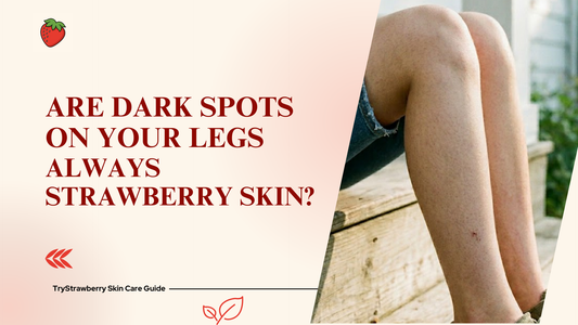 Are Dark Spots on Legs Always Strawberry Skin?
