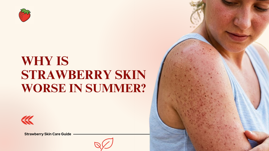 Why Is Strawberry Skin Worse in Summer?
