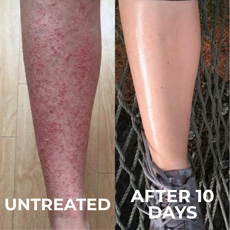 Before and after 8 weeks