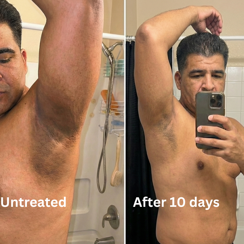 Advanced Triple-Acid Complex for Hyperpigmentation (Copy)