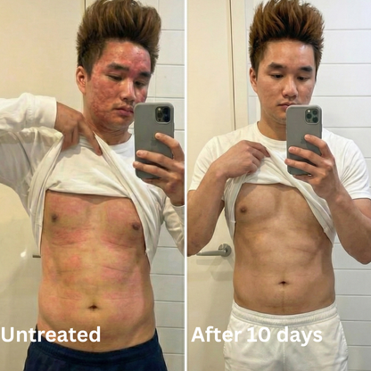 Advanced Barrier Repair Complex for Eczema (Copy)