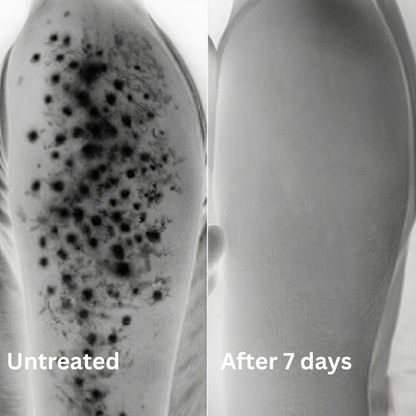 Advanced Triple-Acid Complex for Keratosis Pilaris (Copy)