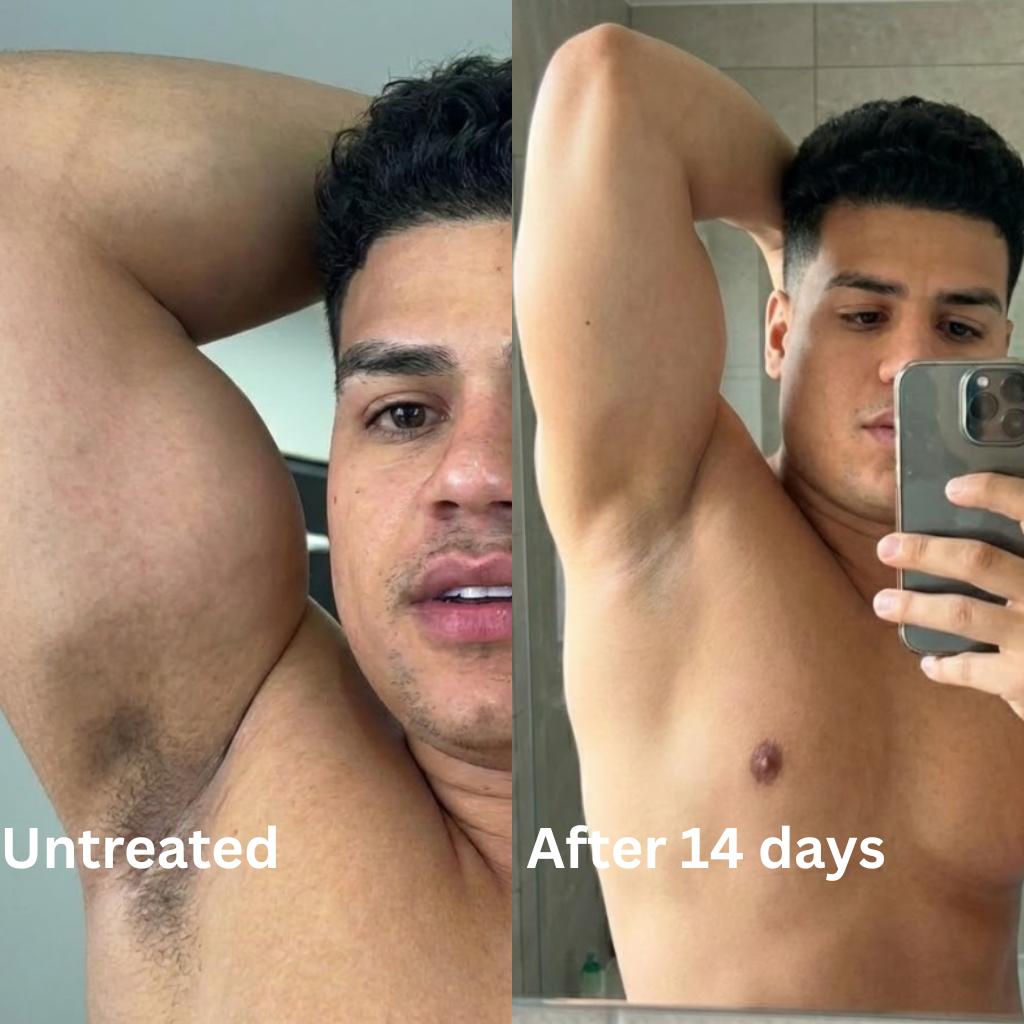 Advanced Triple-Acid Complex for Hyperpigmentation (Copy)