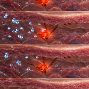 A melanocyte receiving the signal to make pigment, then calming