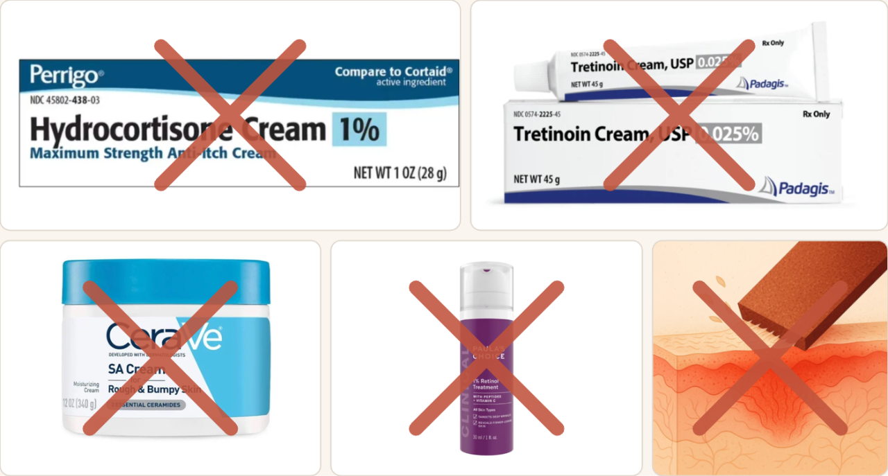 Five failed keratosis pilaris treatments crossed out: hydrocortisone cream, tretinoin, CeraVe SA, Paula's Choice retinol, and exfoliating scrubs