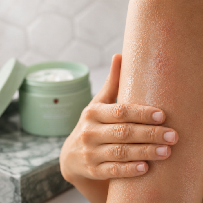 Smoothing the Advanced Barrier Repair Complex onto an arm with visible eczema, the open jar behind