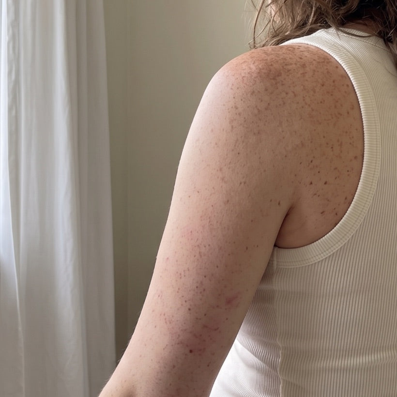 After — the same arm calm and smooth