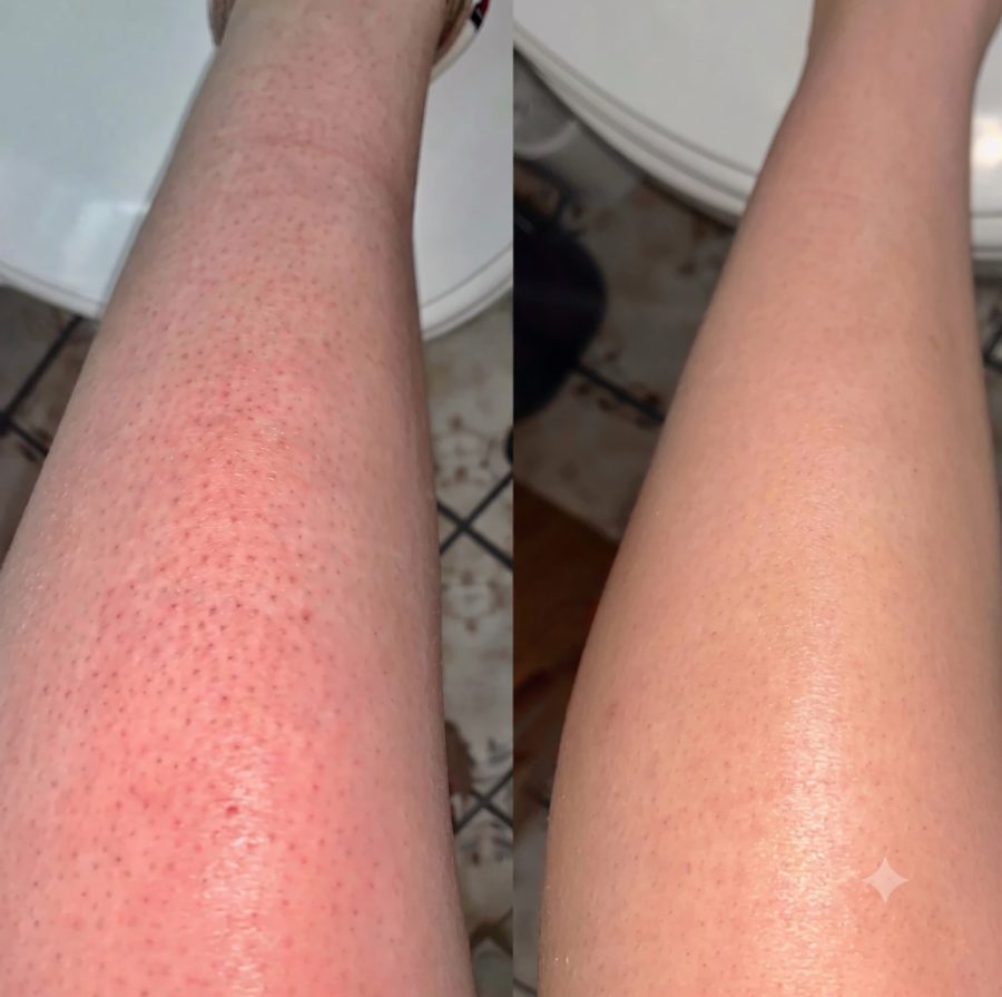 Untreated vs. after 5 uses