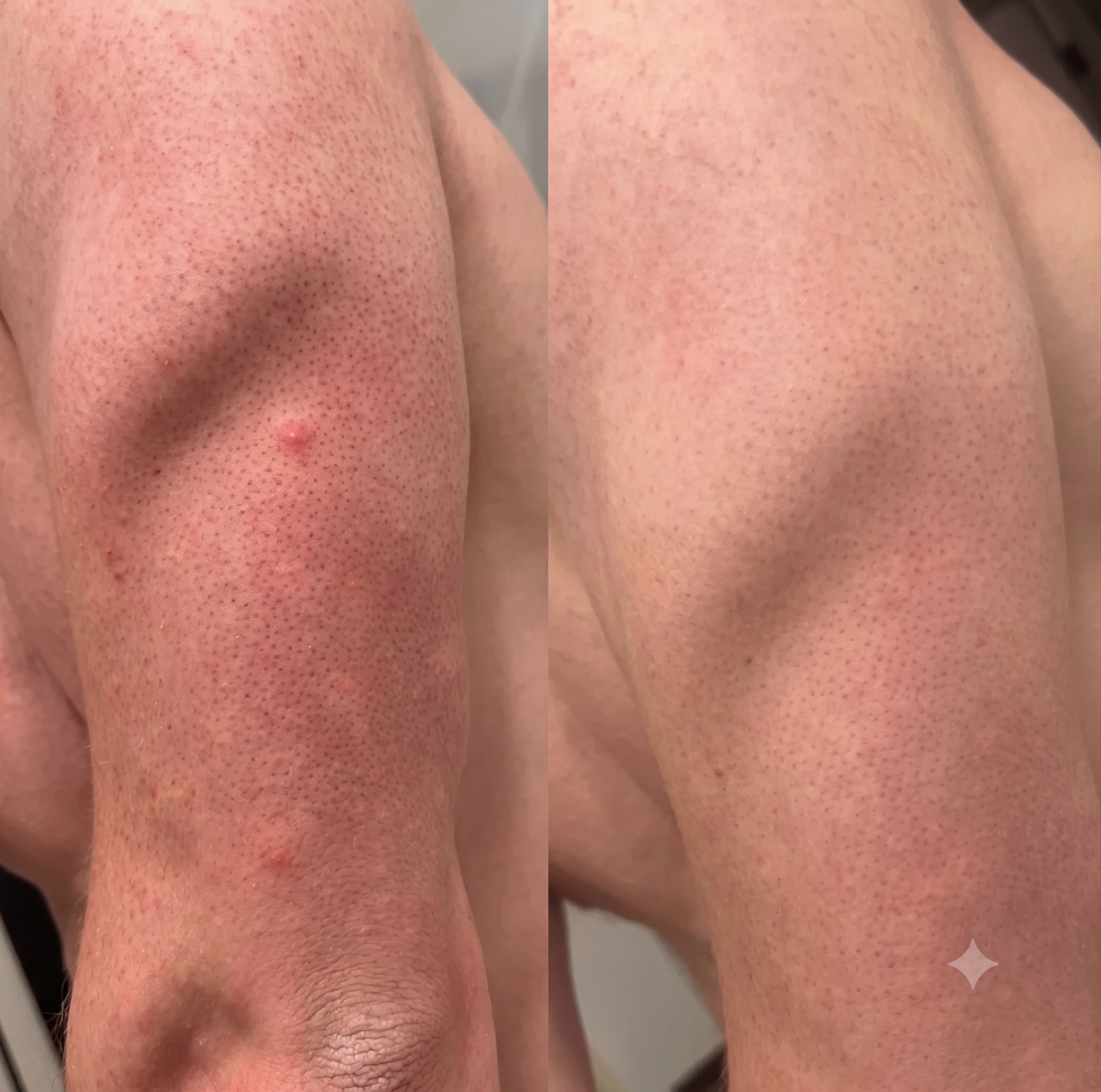 Untreated vs. after 4 days