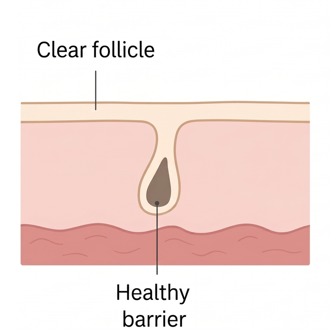 Cross-section of normal skin with a clear follicle and healthy barrier